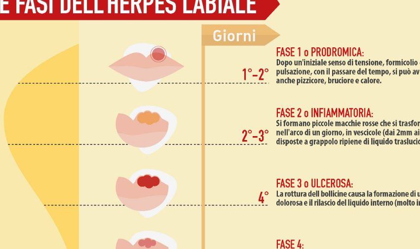 Quanto dura l'herpes simplex?