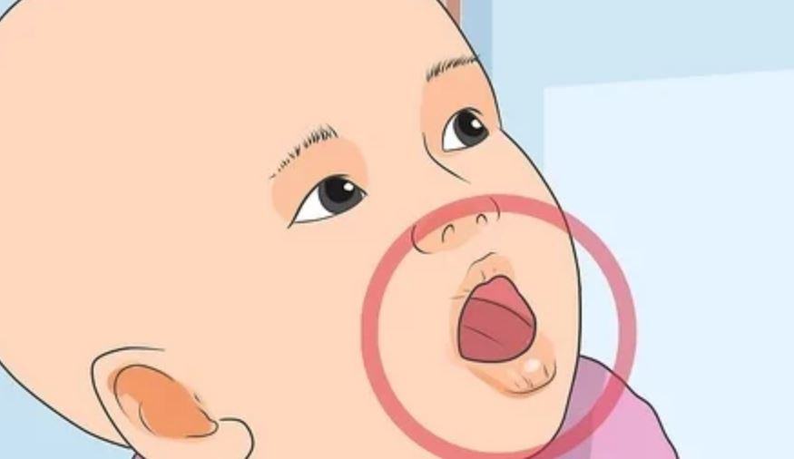 Come capire se un neonato e disidratato