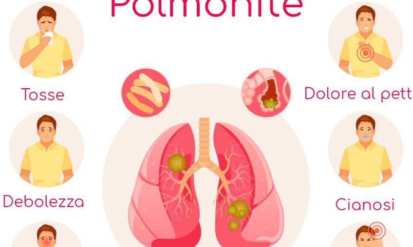 Come si contrae la polmonite da clamidia?