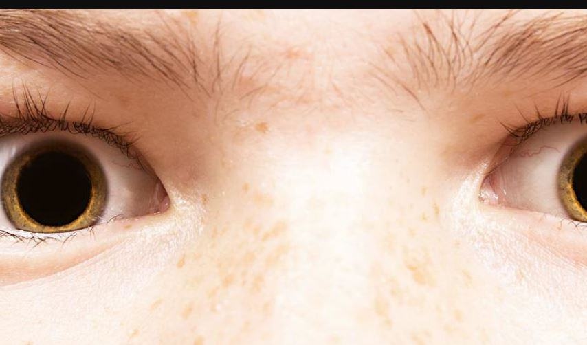 Cosa vuol dire se hai le pupille dilatate?