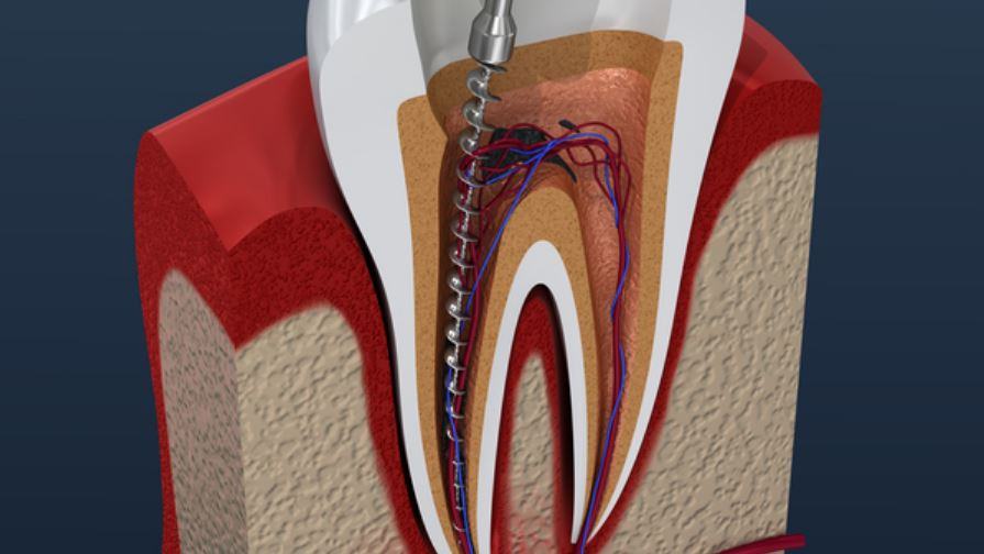 Dove sono attaccate le radici dei denti?