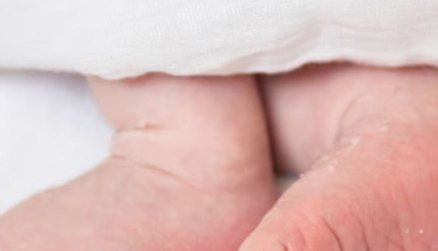 Perché pelle neonato si spella?