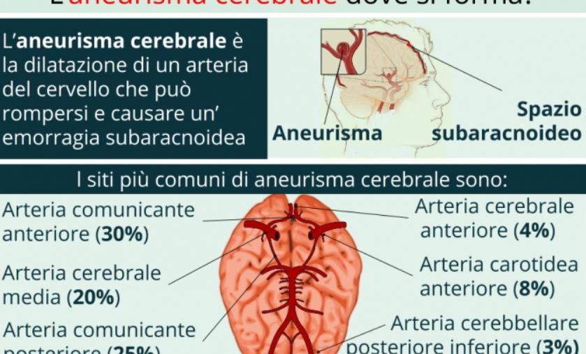 Quali sono i sintomi di aneurisma cerebrale?