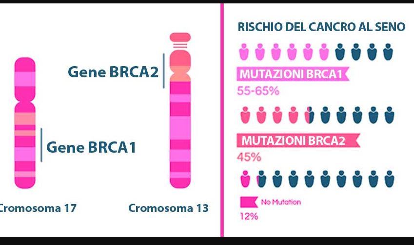 Quanto e ereditario il tumore al seno