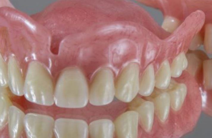 Come discussione più efficacemente via la dentiera?